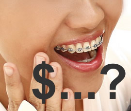Kiek kainuoja dantų breketai?